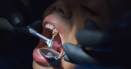 Horizontal video: Child dental cleaning close up 6502312. Duration: 33 seconds. Resolution: 4096x2160