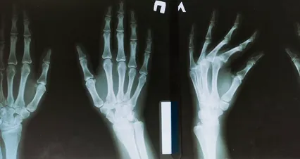 Horizontal video: X ray results 5724102. Duration: 59 seconds. Resolution: 4096x2160