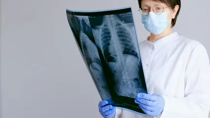 Horizontal video: Female doctor looking at an x ray 4316868. Duration: 12 seconds. Resolution: 3840x2160