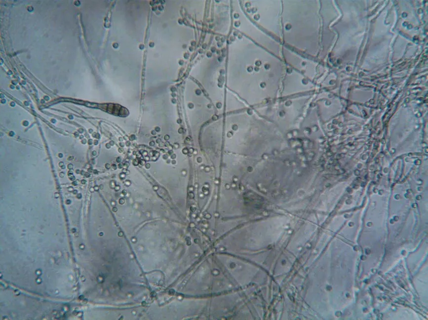 A Microorganism under a Microscope