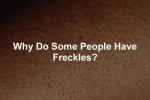 Featured image for Why Do Some People Have Freckles?