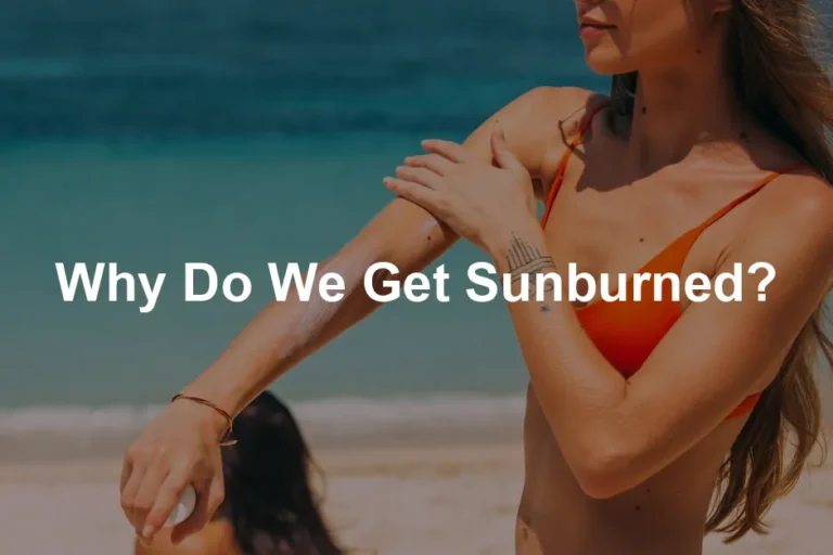 Featured image for Why Do We Get Sunburned?