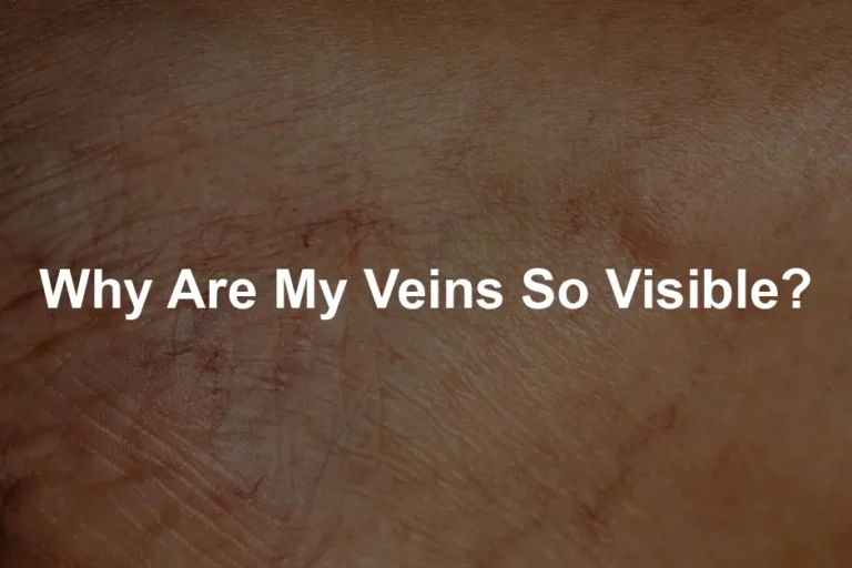 Featured image for Why Are My Veins So Visible?